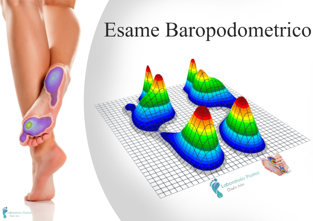 Esame Baropodometrico , Laboratorio plantari totei