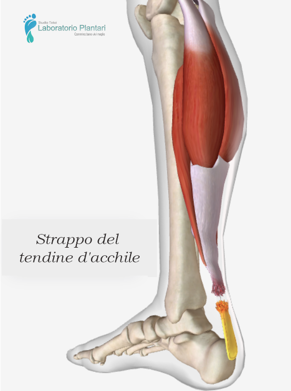 Laboratorio Plantari Totei Tendine dacchile 2