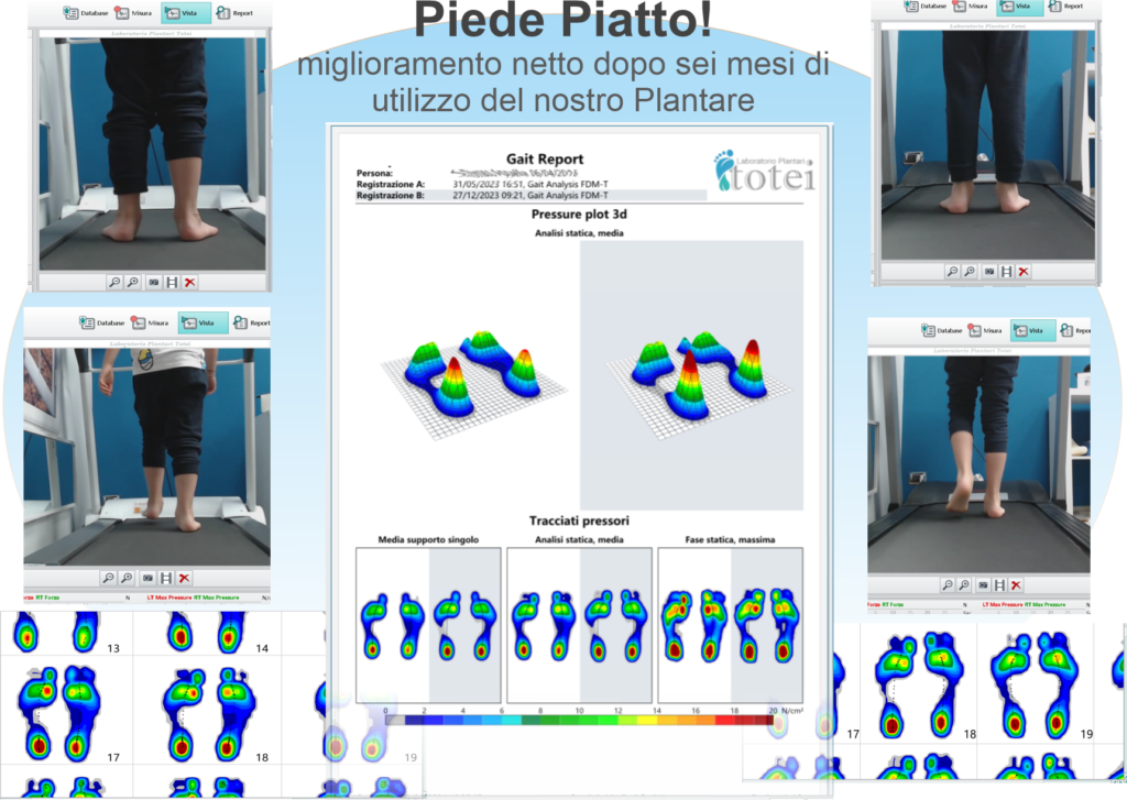 Laboratorio Plantari Totei Piede Piatto Migliorato